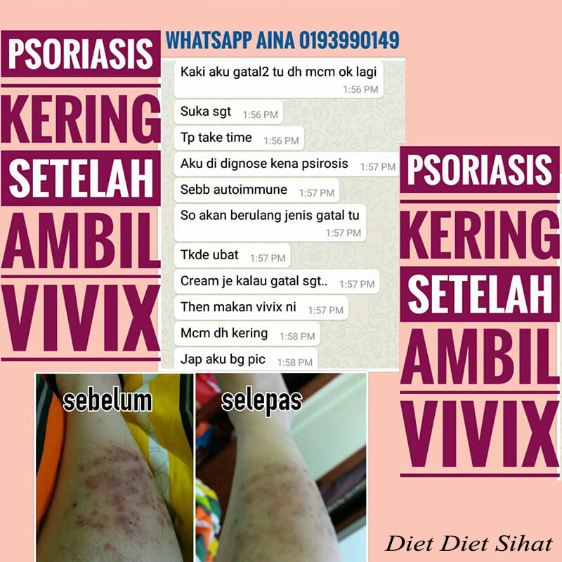 psoriasis kering vivix
