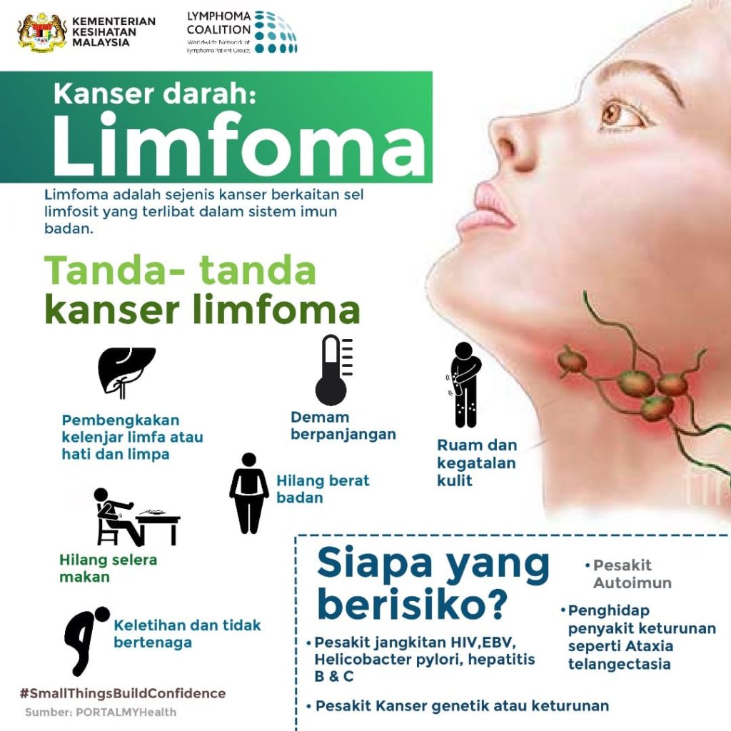 Bebas kanser Limfoma